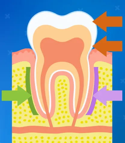 Orthodontic Treatments