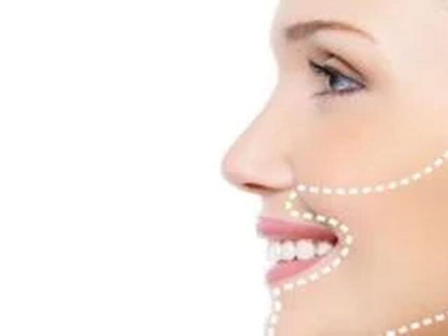 Ortognatik Cerrahi Ameliyatı