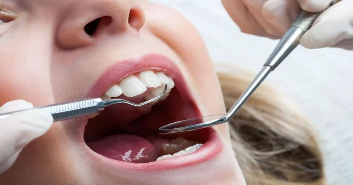 Diş Çürümesi